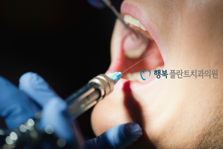 천안 안아픈치과 행복플란트치과의 세심한 마취 과정